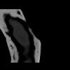SPORK, NICO - 22.03.1976 - 02.08.2022 - CT obere Extremität - 18:01:46